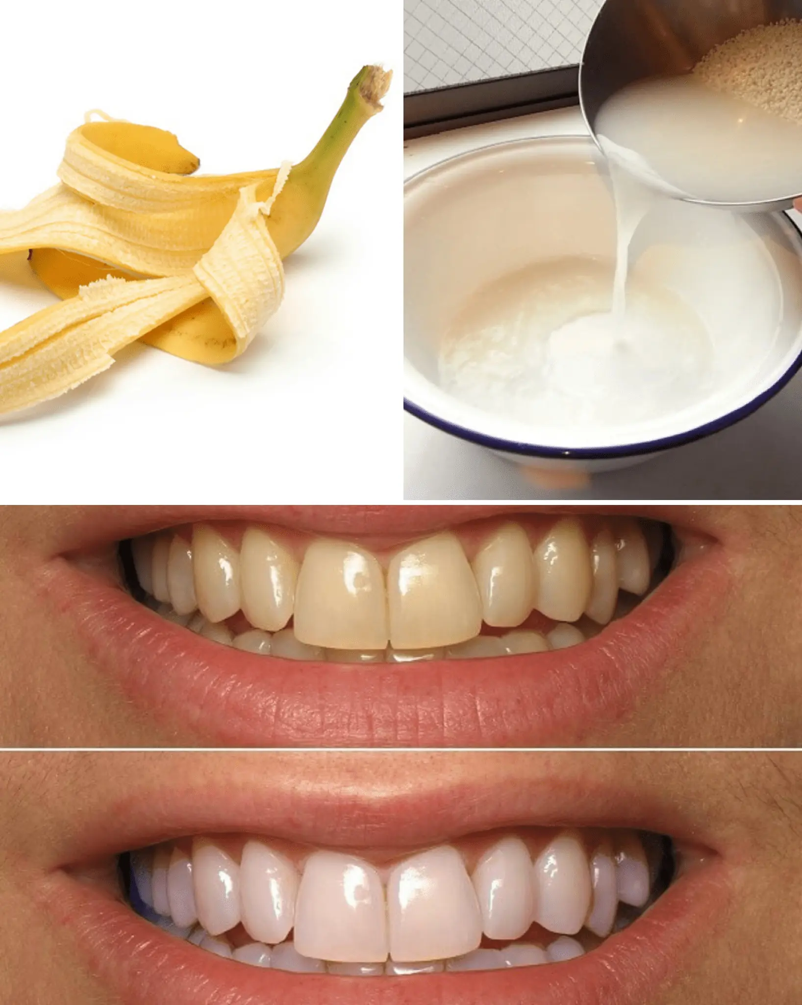 Natural Teeth Whitening at Home – 4 Simple & Effective Methods 🦷✨