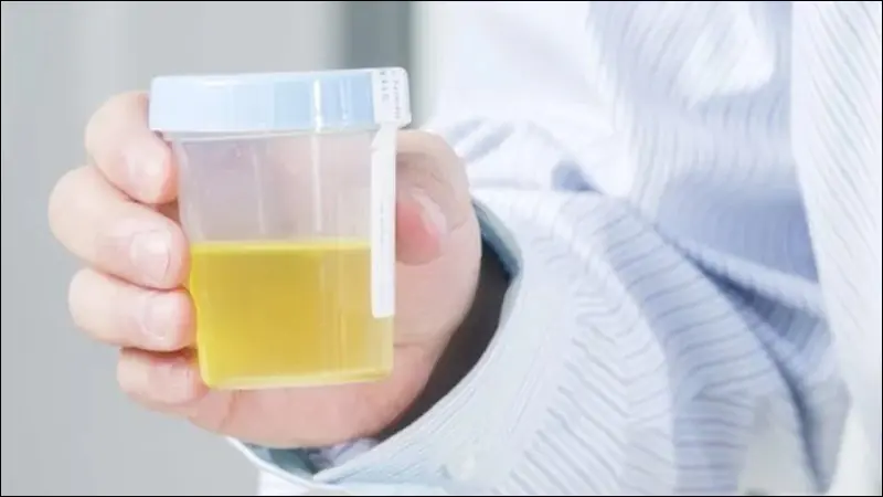 Does Foul Smelling Urine Indicate Cancer Understanding The Causes And does-foul-smelling-urine-indicate-cancer-understanding-the-causes-and