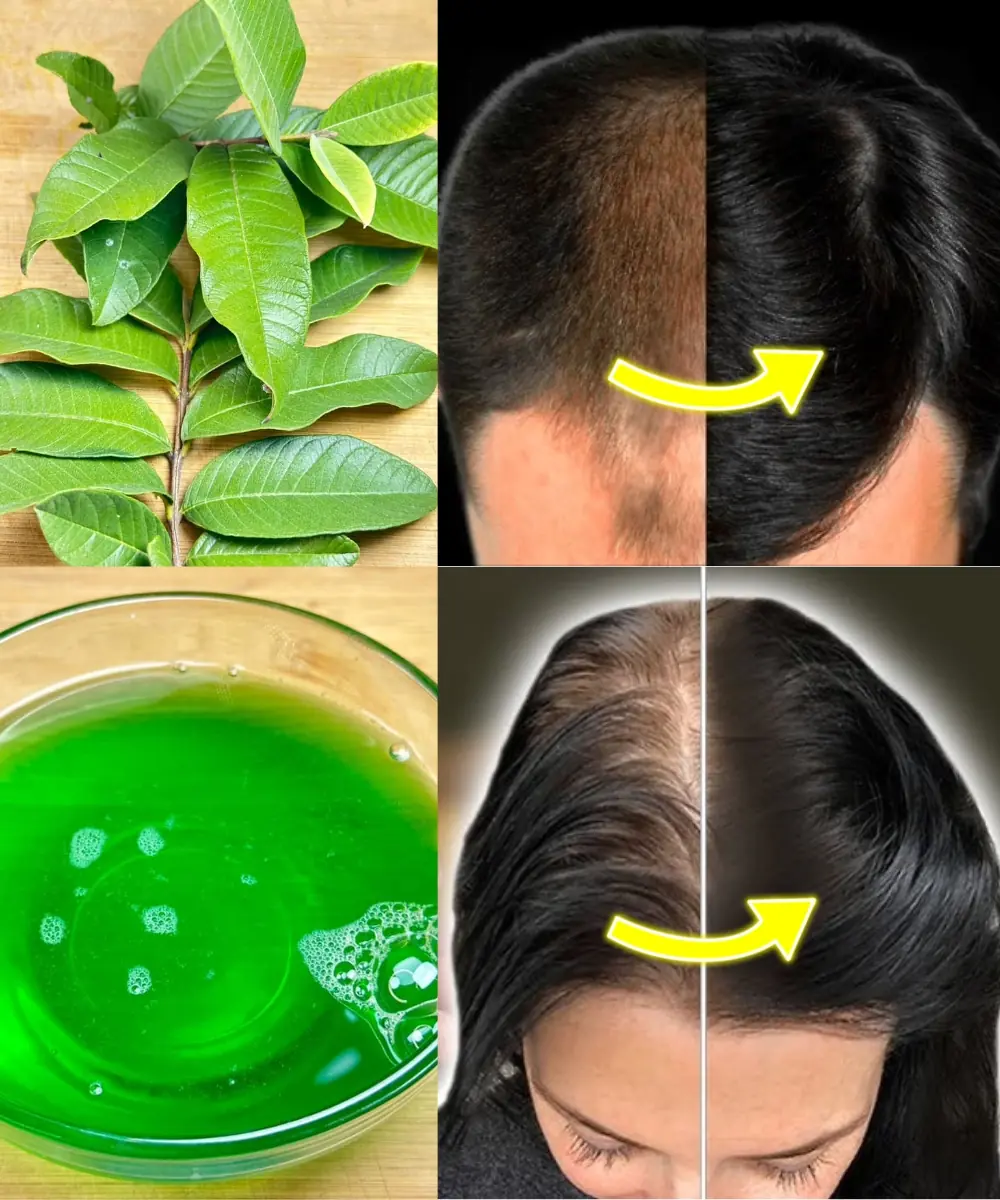 DIY Miracle Shampoo to Stop Hair Loss & Regrow Hair – Even on Bald Spots!