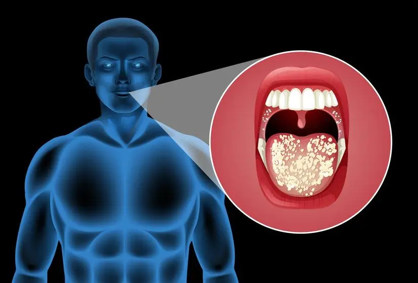 Is Oral Cancer a Result of Ignoring Symptoms? 6 Warning Signs You Shouldn’t Overlook