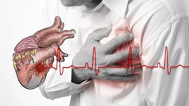 How to Prevent Angina? Three Key Factors to Keep in Mind, with Medication as the First Priority