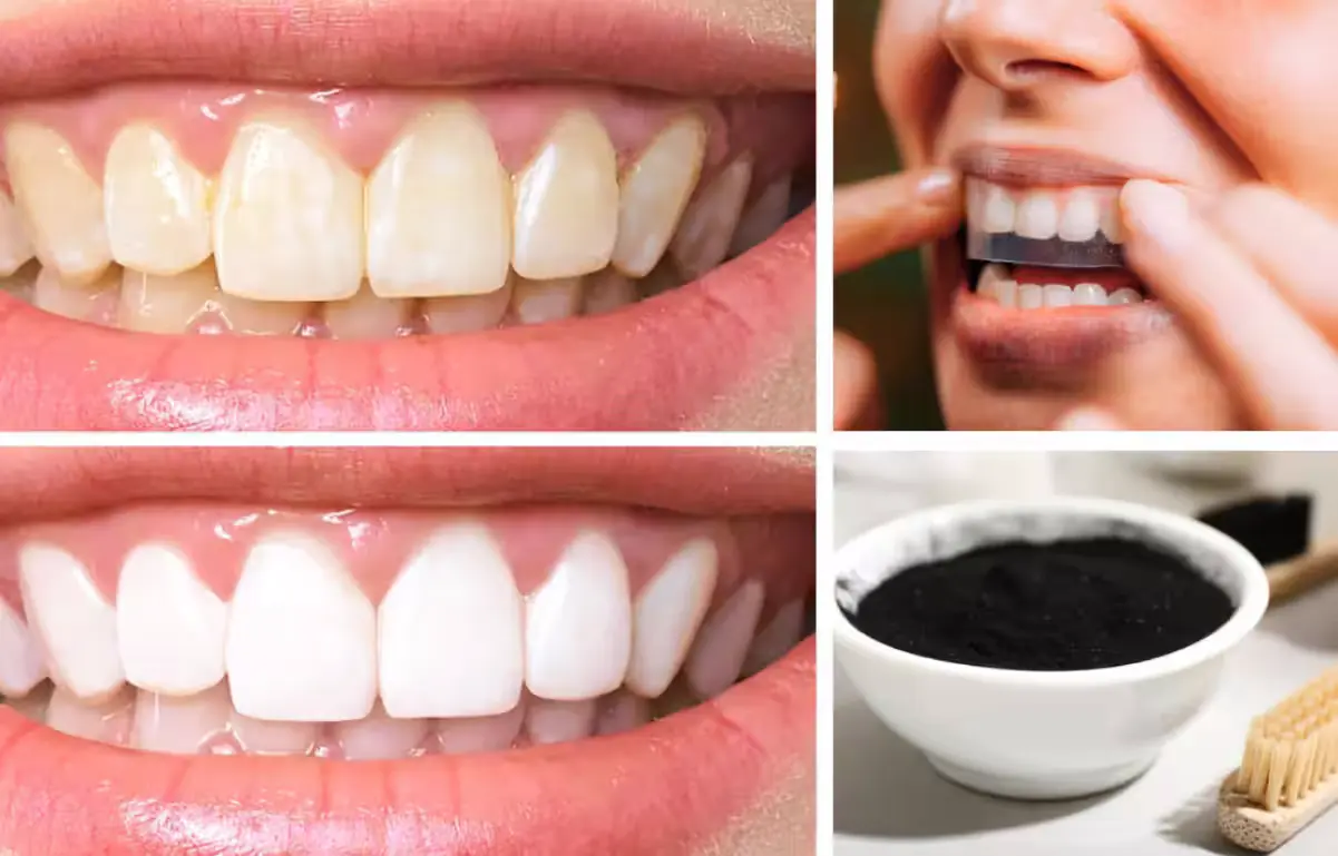 16 Simple and Effective Ways to Whiten Your Teeth Overnight at Home