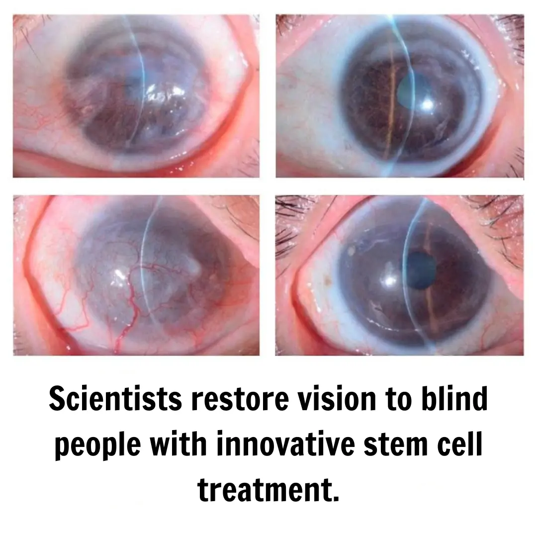 Japanese Scientists Restore Vision in Blind Individuals