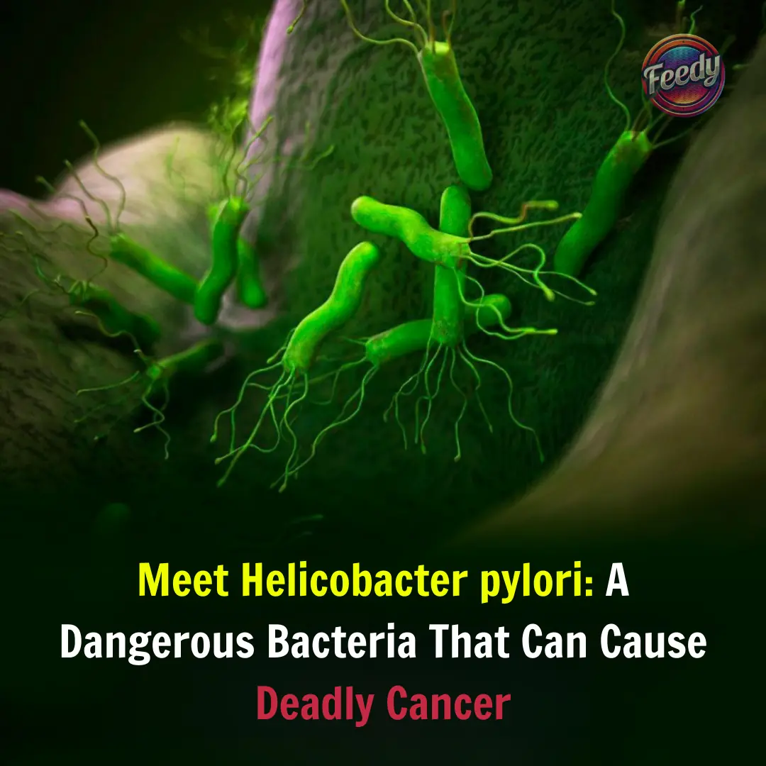 Meet Helicobacter pylori: A Dangerous Bacteria That Can Cause Deadly Cancer