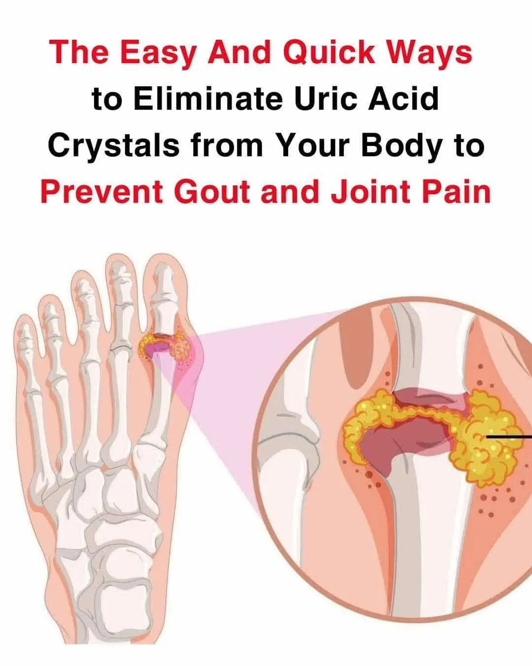 How to help naturally relieve gout and joint pain