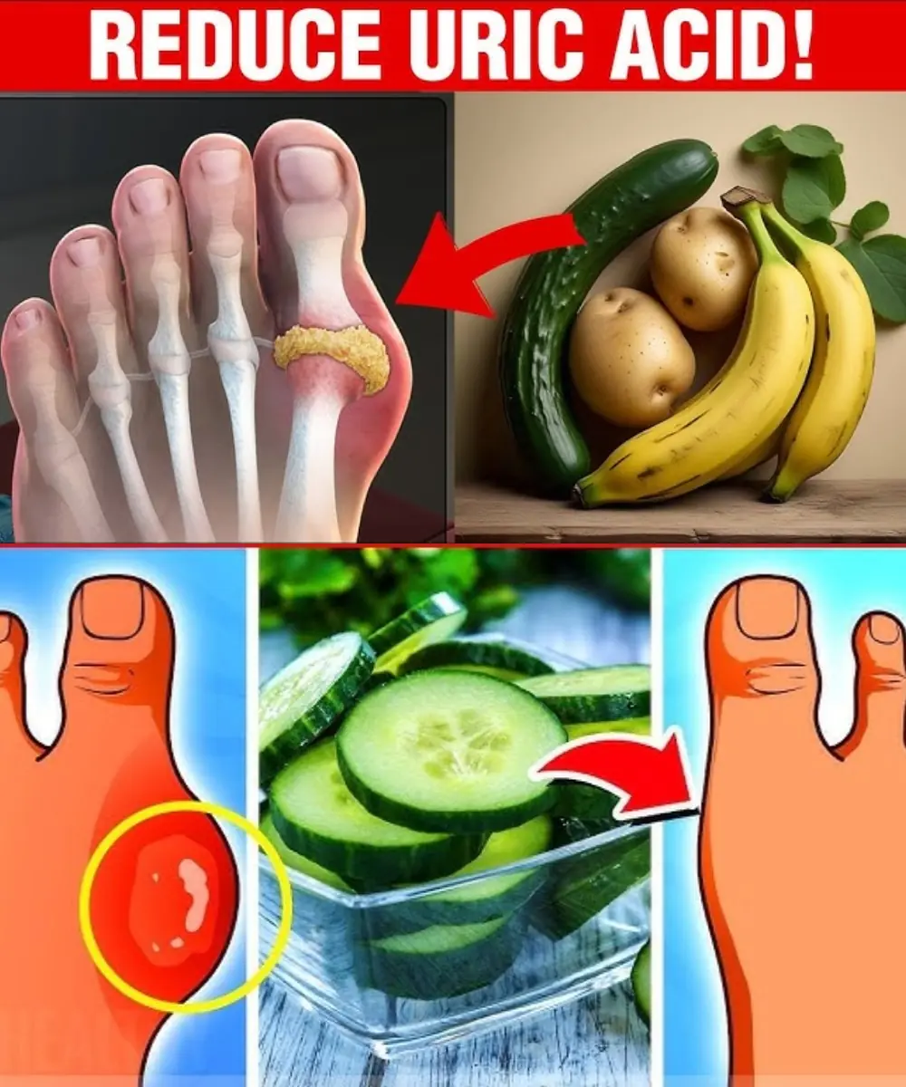 8 Easy Ways to Eliminate Excess Uric Acid: Natural Remedies and Practical Tips