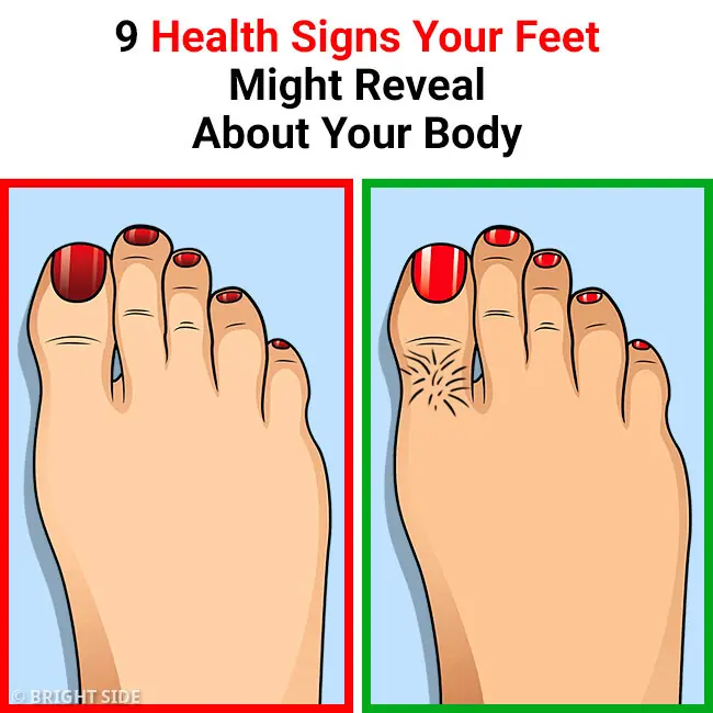 9 Health Signs Your Feet Might Reveal About Your Body