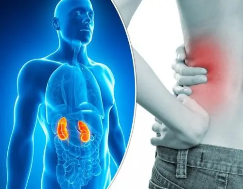 If You Notice These Signs in Your Back and Legs, Pay Attention to Your Kidneys Before It’s Too Late!