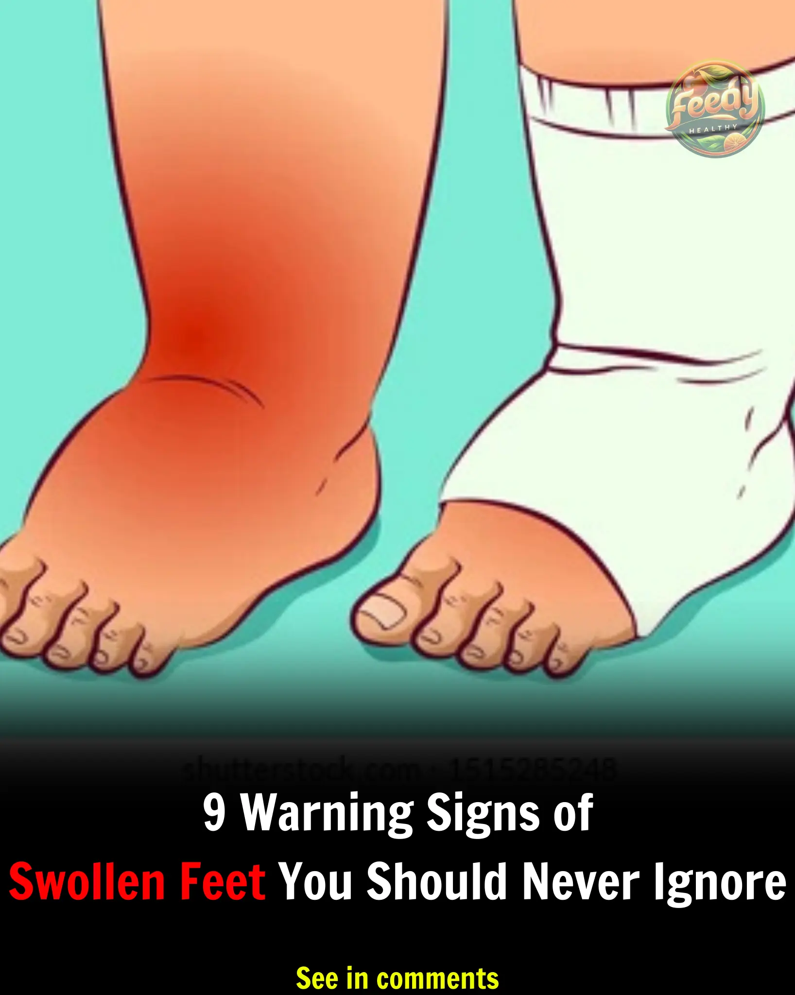 10 Swollen Feet Causes + When To See Your Doctor