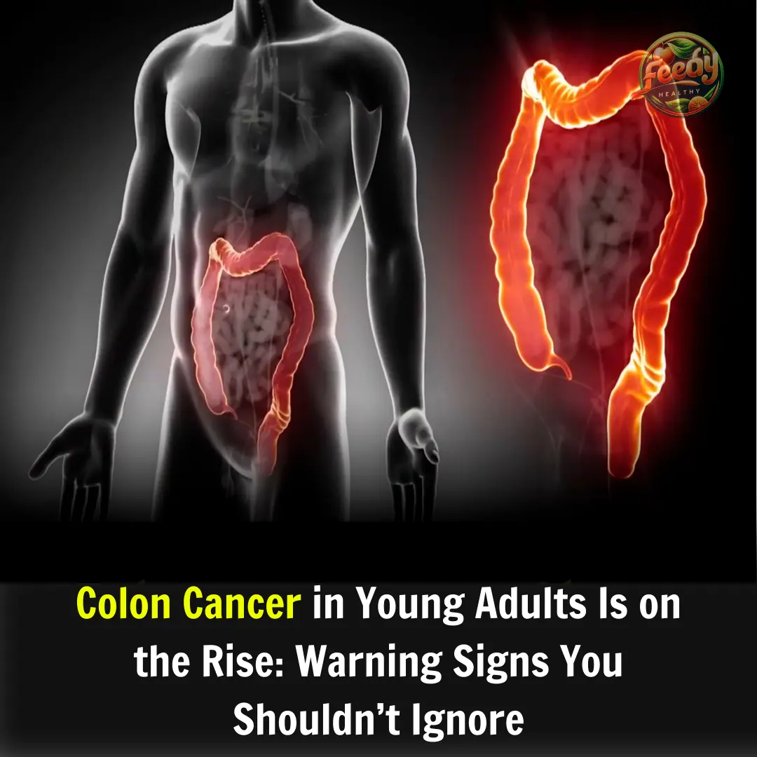 Colon Cancer in Young Adults Is on the Rise: Warning Signs You Shouldn’t Ignore