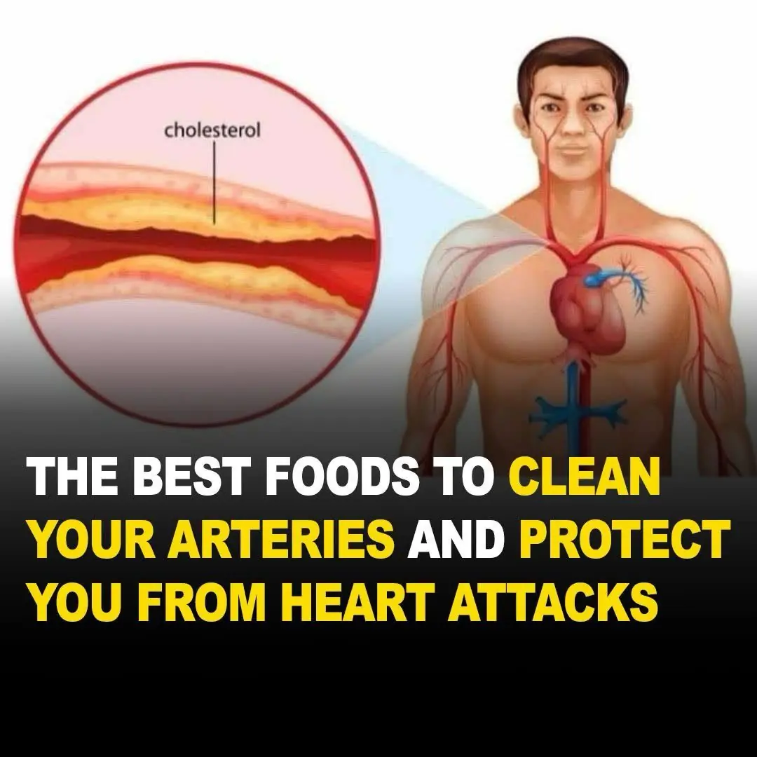 10 Foods That You Should Eat Daily For Clean Arteries