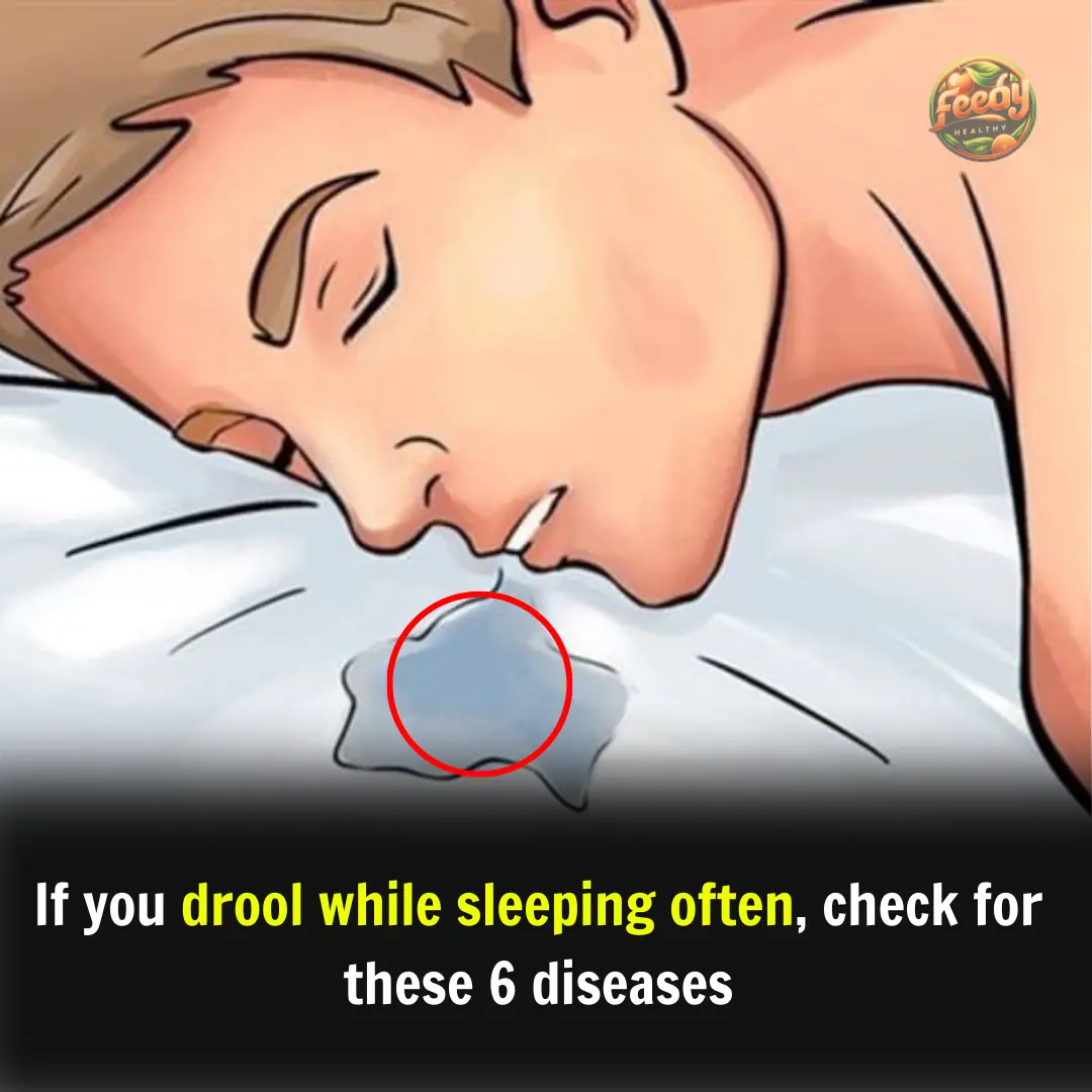 If you drool while sleeping often, check for these 6 diseases