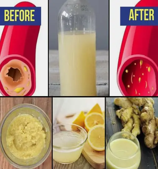 Only a Glass of this Juice will remove Clogged Arteries – Only polite members say thank you