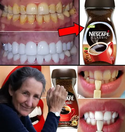 Whiten your teeth at home naturally and effectively in just two minutes for a bright smile – Only polite members say thank you