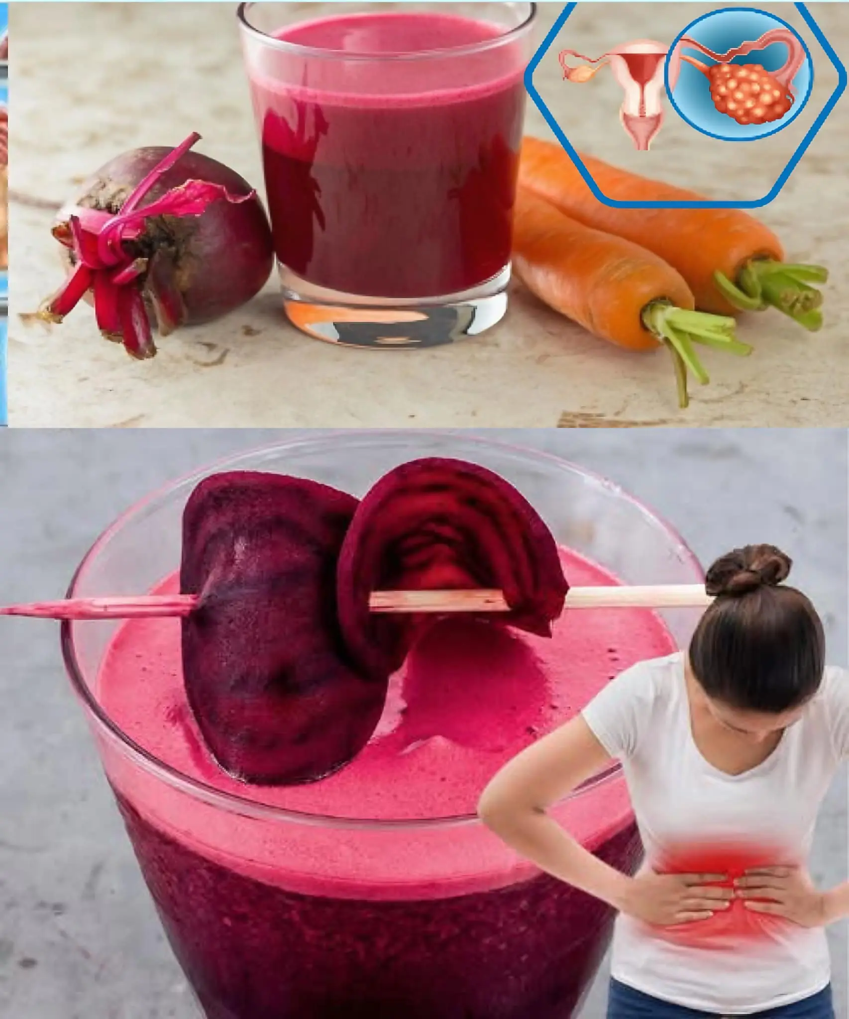 Beetroot for Health: Eliminate Anemia, Cysts, and Fibroids with This Juice!