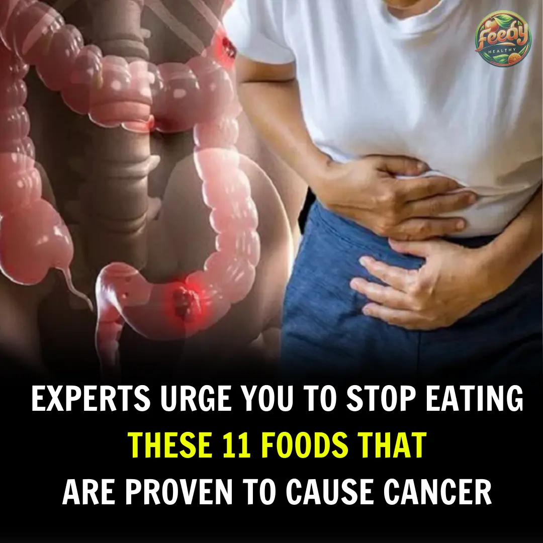 10 Cancer-Linked Foods You Should Never Put in Your Mouth Again