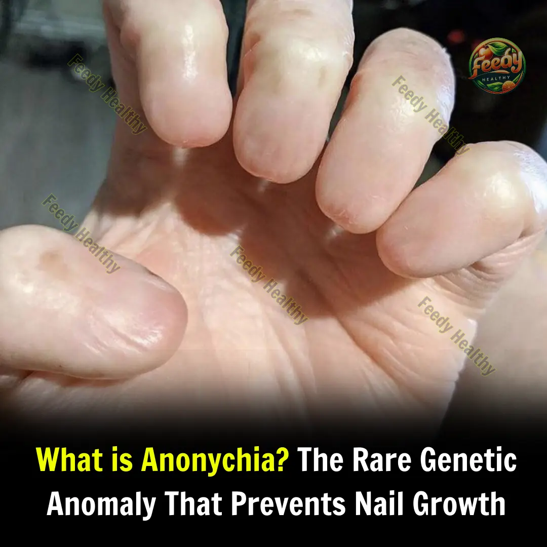 What is Anonychia? The Rare Genetic Anomaly That Prevents Nail Growth