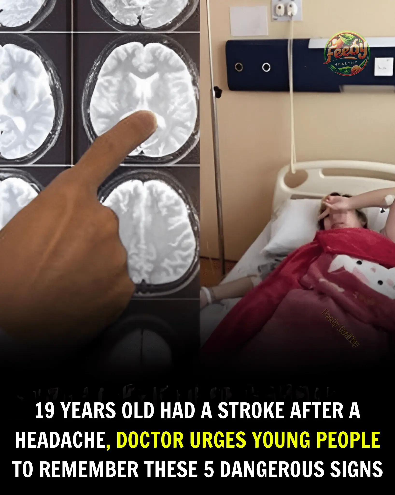 5 Alarming Stroke Warning Signs to Watch for in Young People