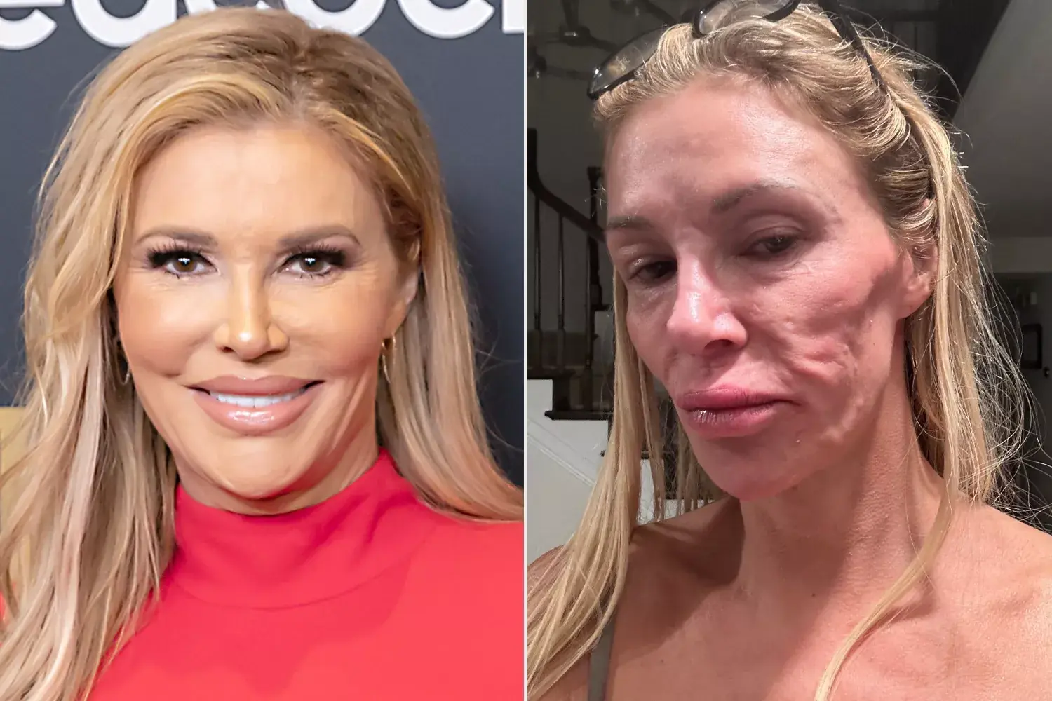 Brandi Glanville Says There's an 'Oily Foul-Tasting Drainage' from Her Face That's 'Eating Away at My Teeth'