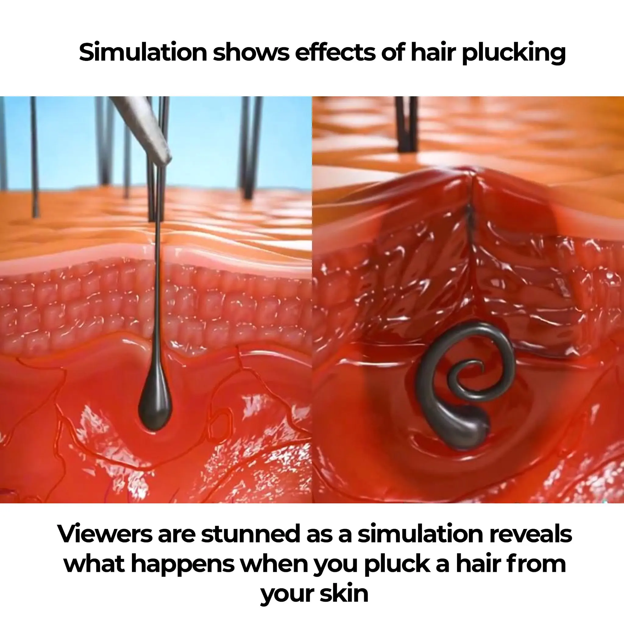 Viewers are stunned as a simulation reveals what happens when you pluck a hair from your skin