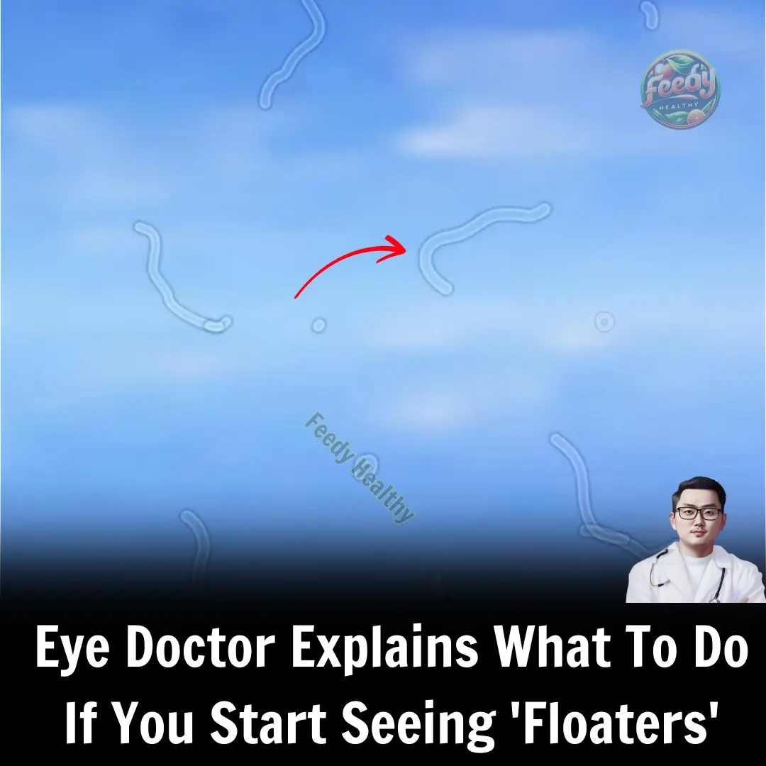 What Are Eye Floaters? Here What To Do If you Start Seeing Them, According to an Eye Doctor