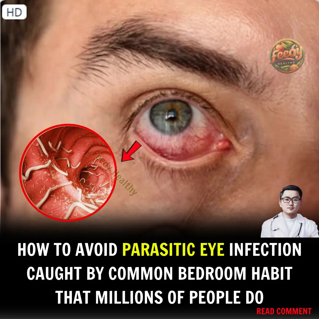 How to Avoid Parasitic Eye Infection Caught by Common Bedroom Habit That Millions of People Do