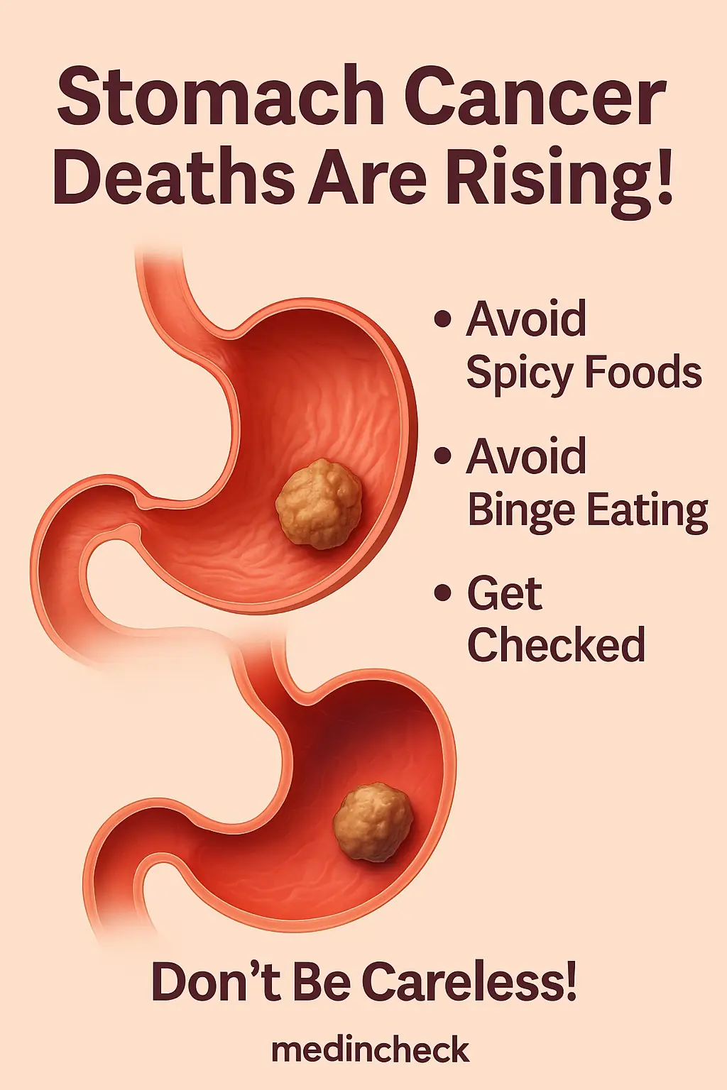 Stomach Cancer Deaths Are Rising! A Word of Advice: Avoid Spicy Foods, Avoid Binge Eating, and Get Checked — Don’t Be Careless!