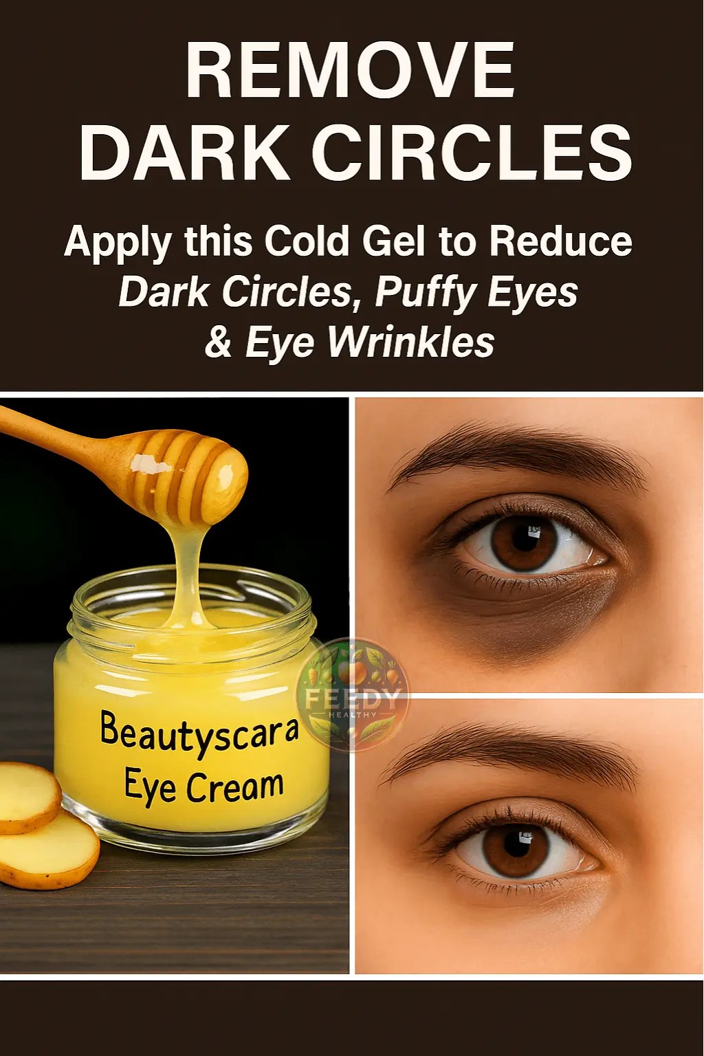 Treat Dark Circles, Sunken Eyes & Puffy Eyes with Home Remedies and Eye Creams