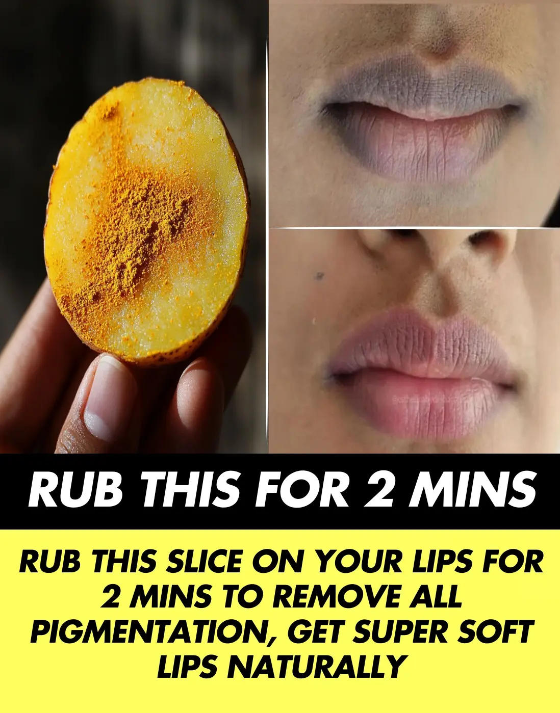 Super Effective DIYs to Get Soft Lips
