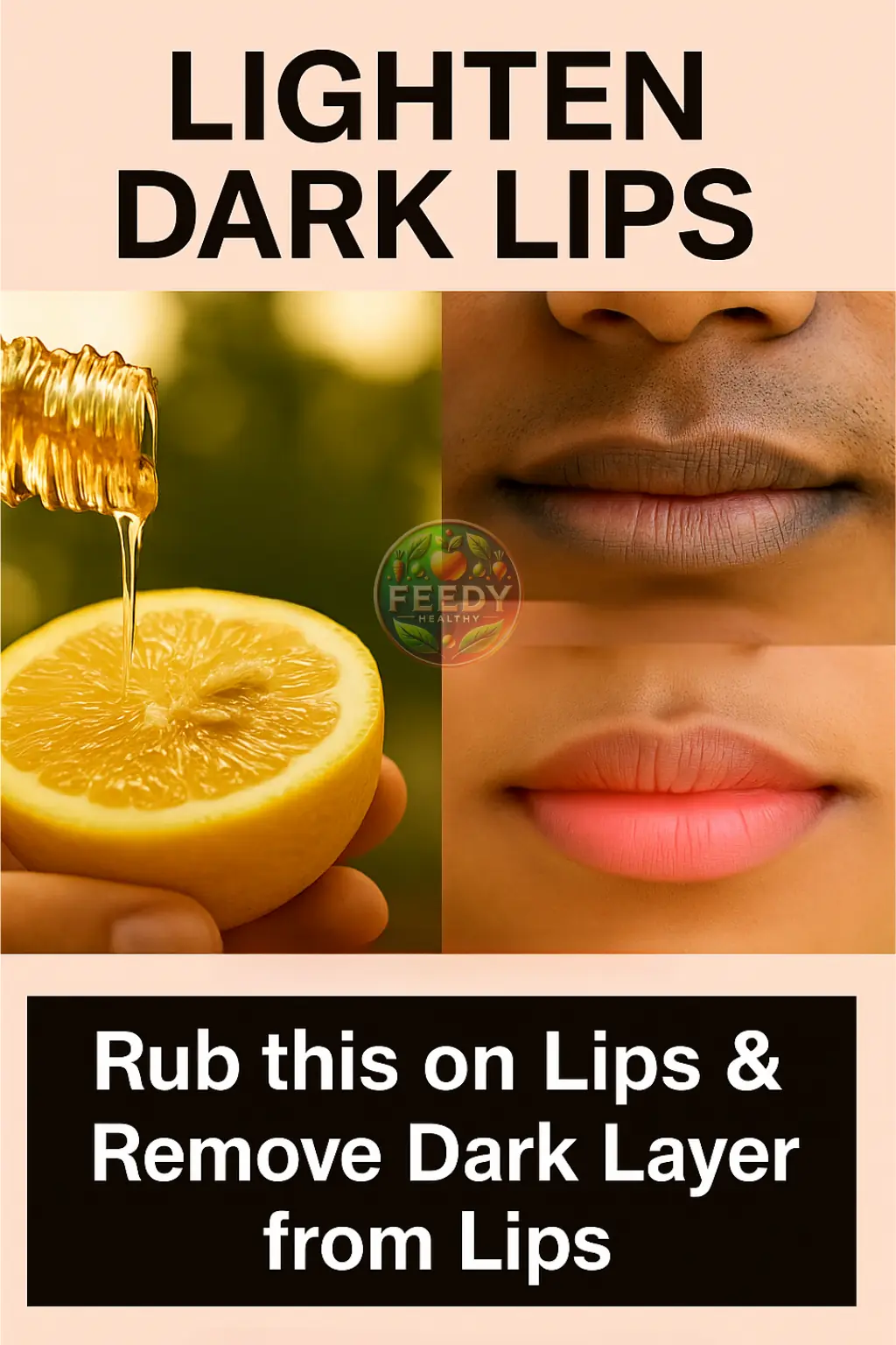 How to Get Naturally Soft, Pink Lips: 10 Proven Home Remedies
