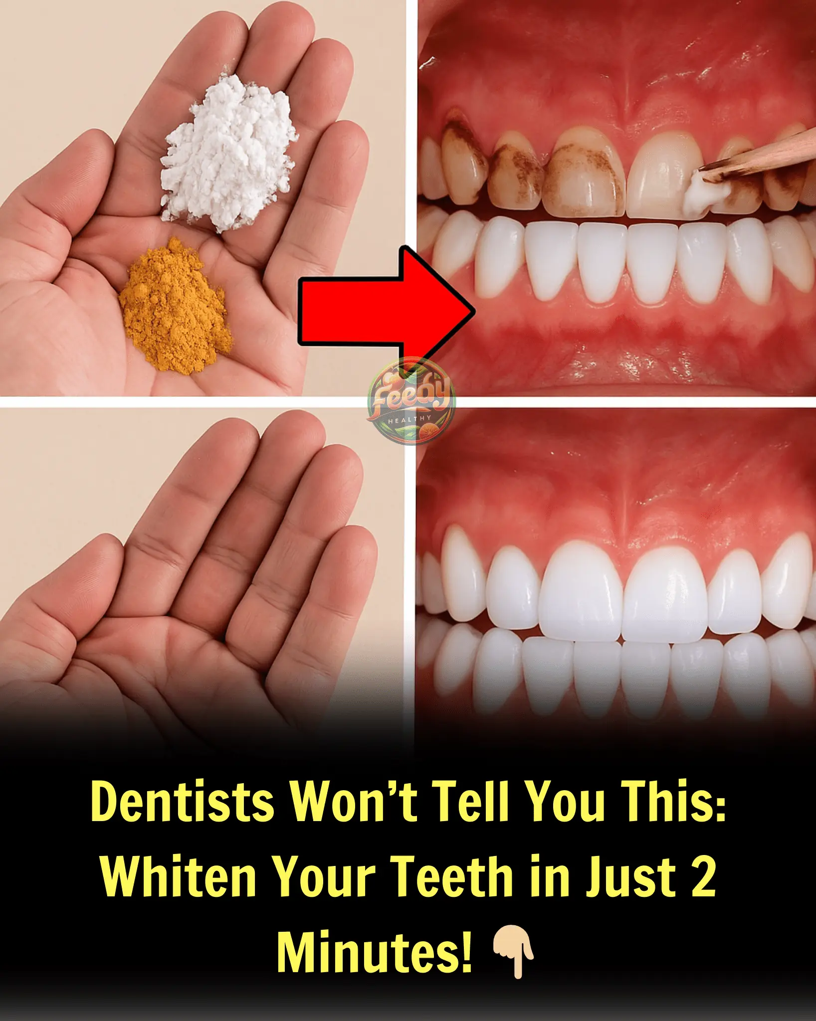 Dentists Won’t Tell You This: Whiten Your Teeth in Just 2 Minutes! 👇🏼