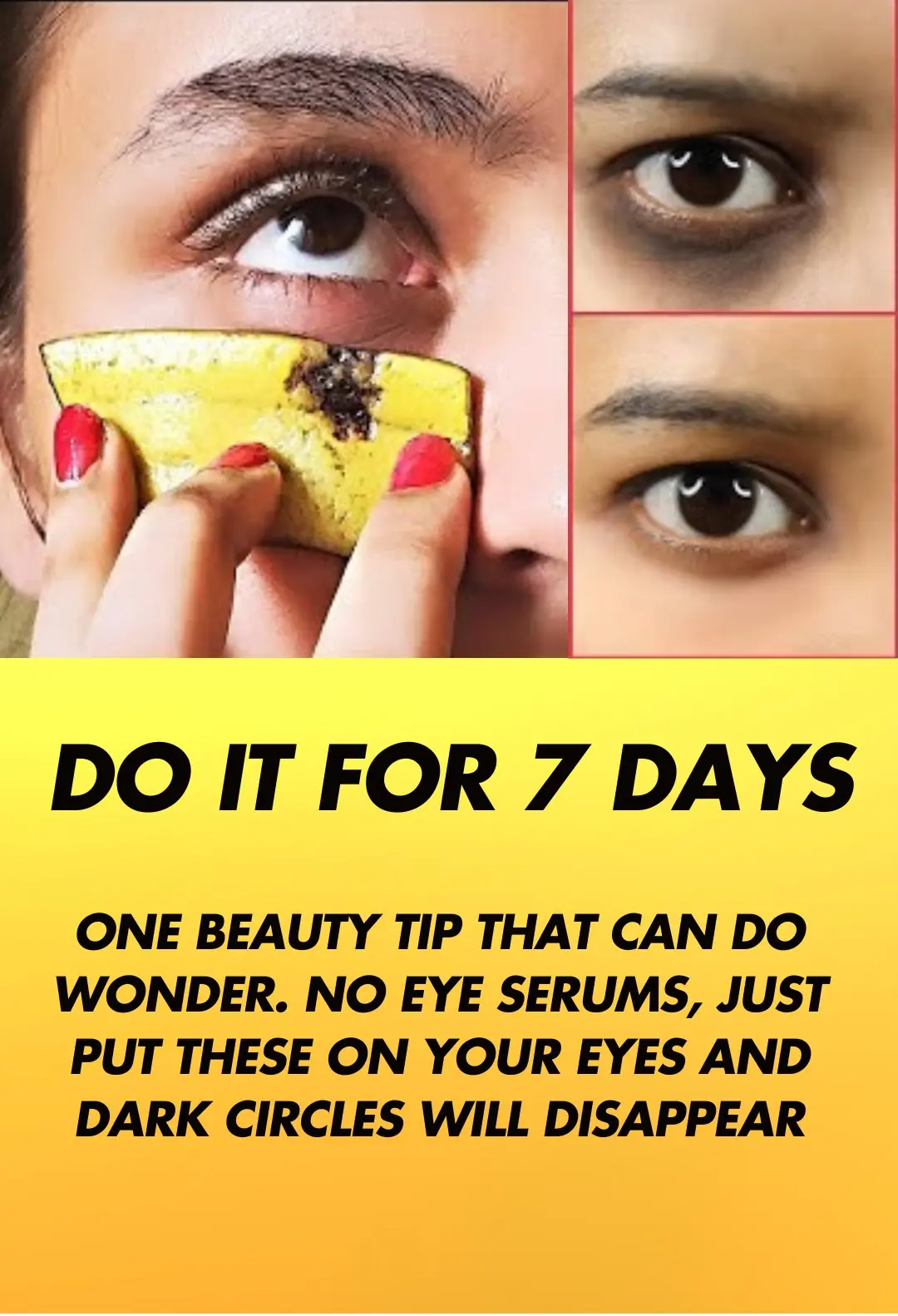 Banana peels for dark circles