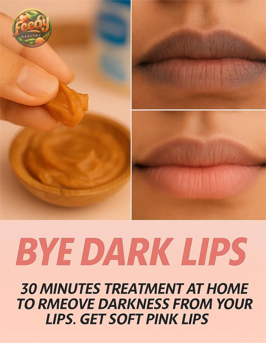 30 Minutes Treatment For Dark Lips