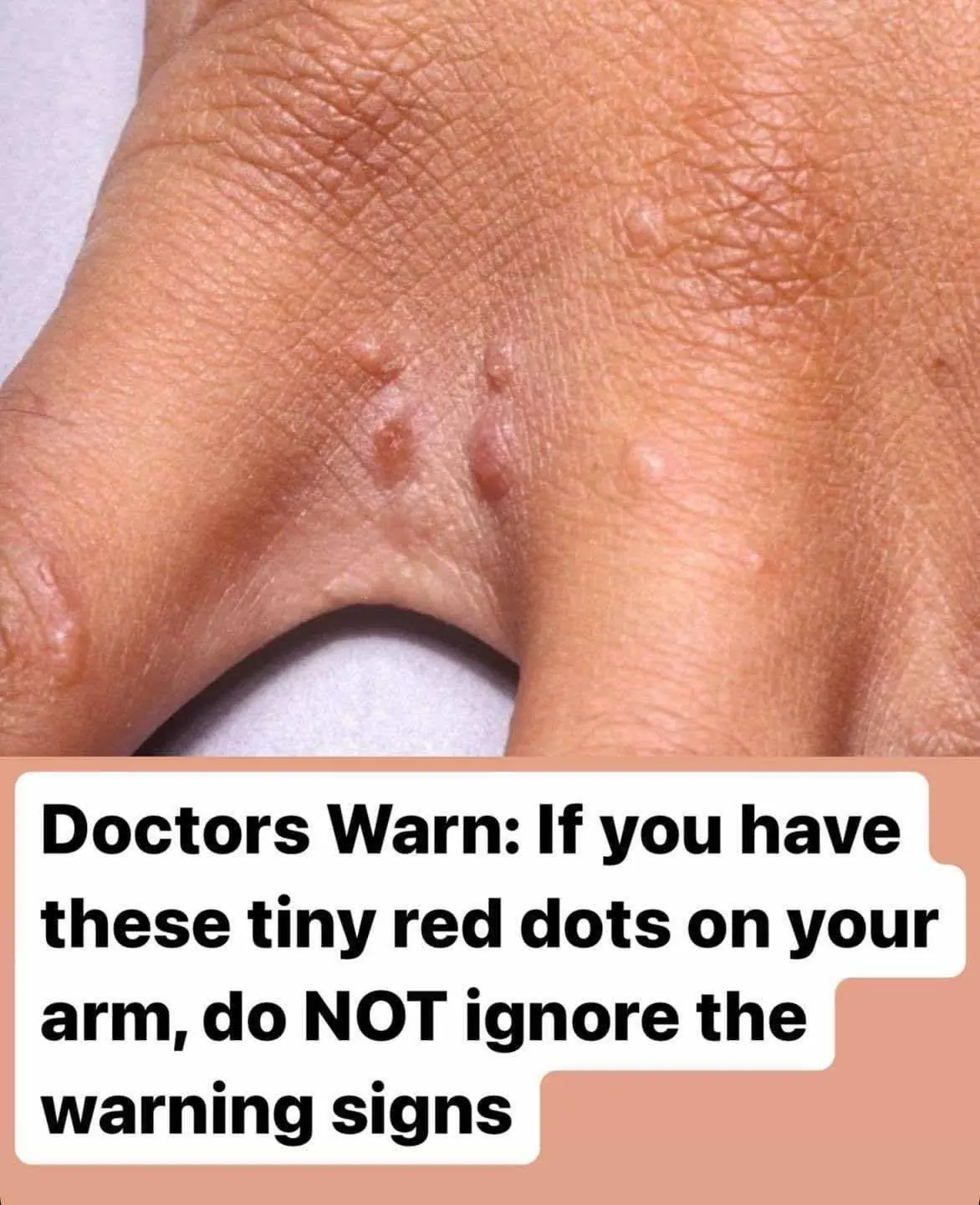 Don’t overlook these small red spots on your arm – They could be important warning signs