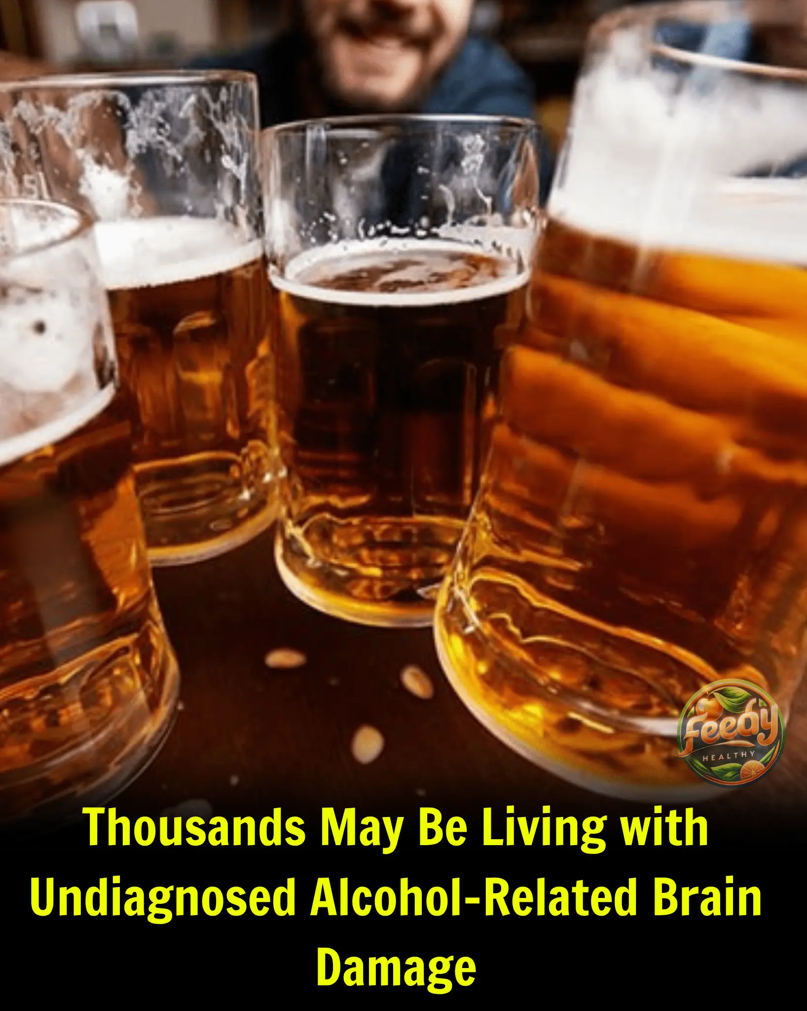 Thousands May Be Living with Undiagnosed Alcohol-Related Brain Damage