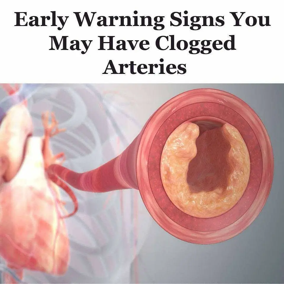 10 Clues Your Body Might Be Giving You About Clogged Arteries