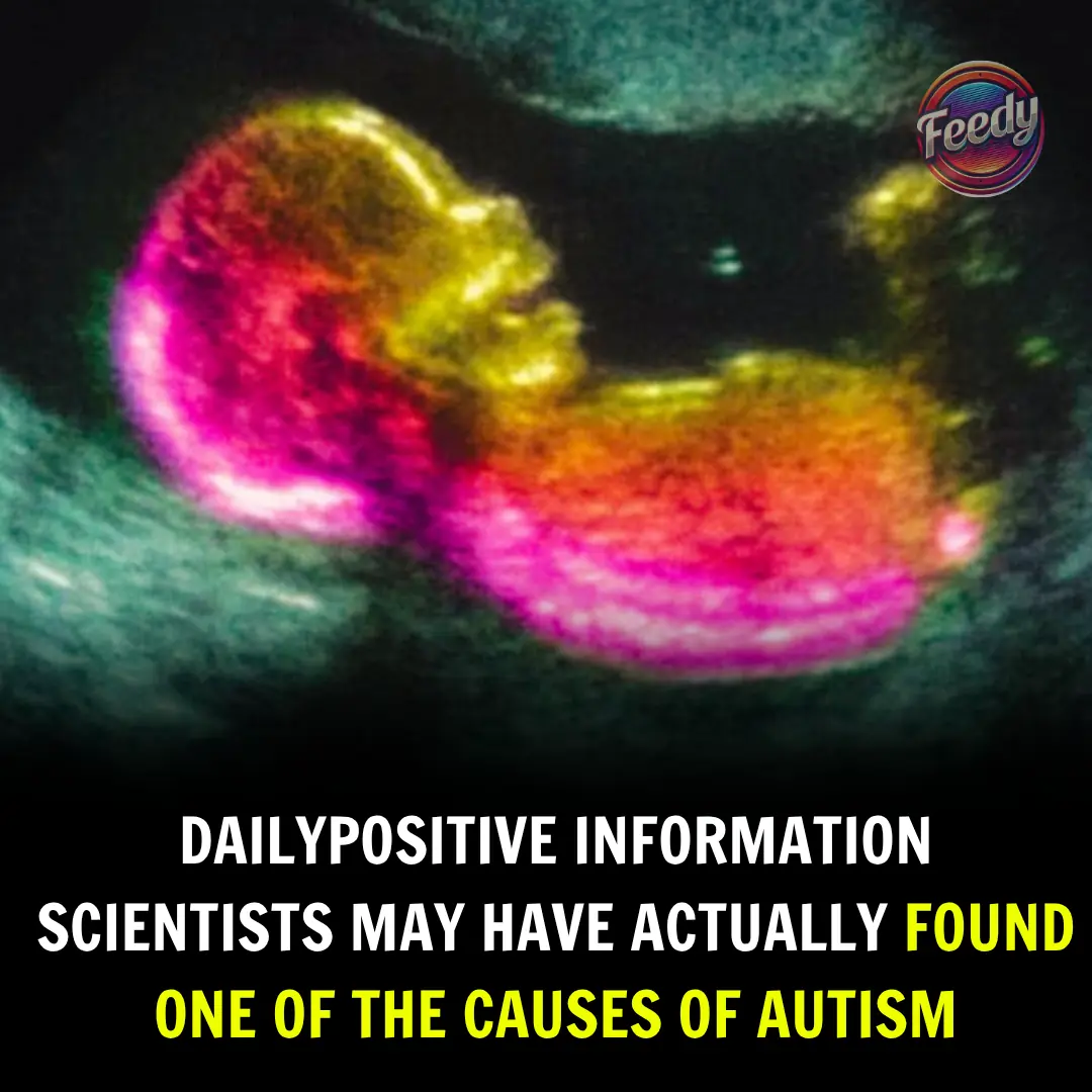 Study Suggests Key Link That Could Help Explain Autism Development