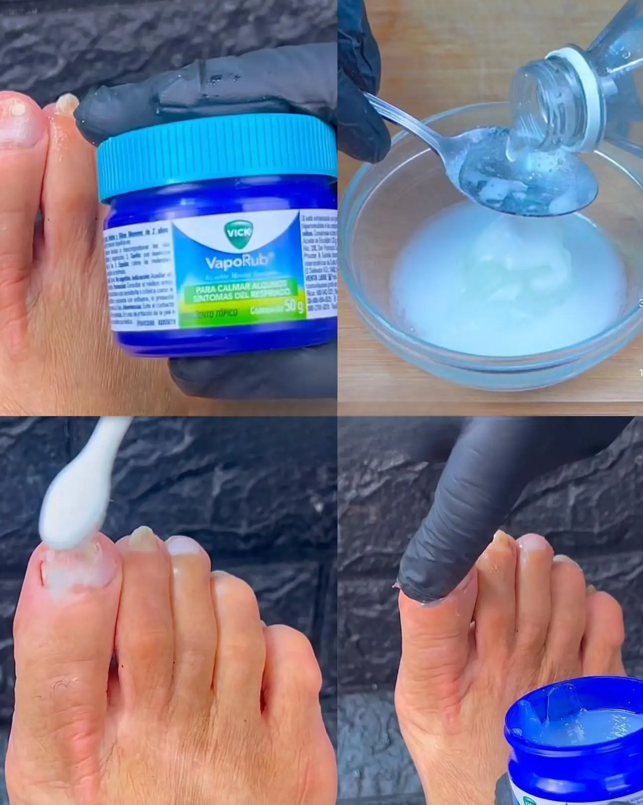 If you want to effectively and naturally eliminate toenail fungus, try this homemade mixture