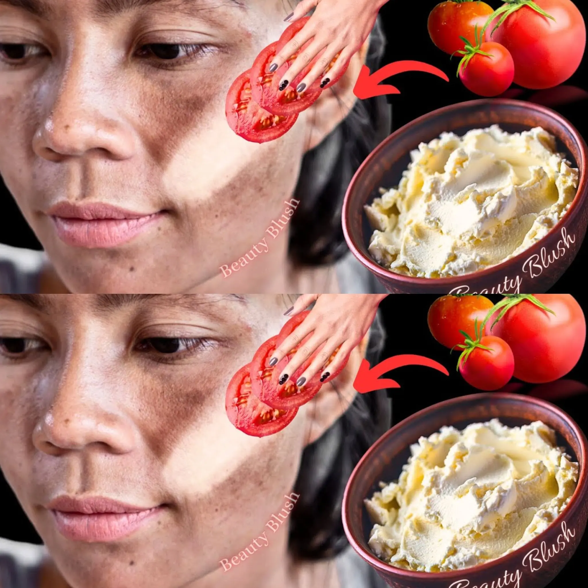 Look Fresh & Youthful with This Simple Tomato & Cornstarch MaskFeel Like 16 Again – Naturally!