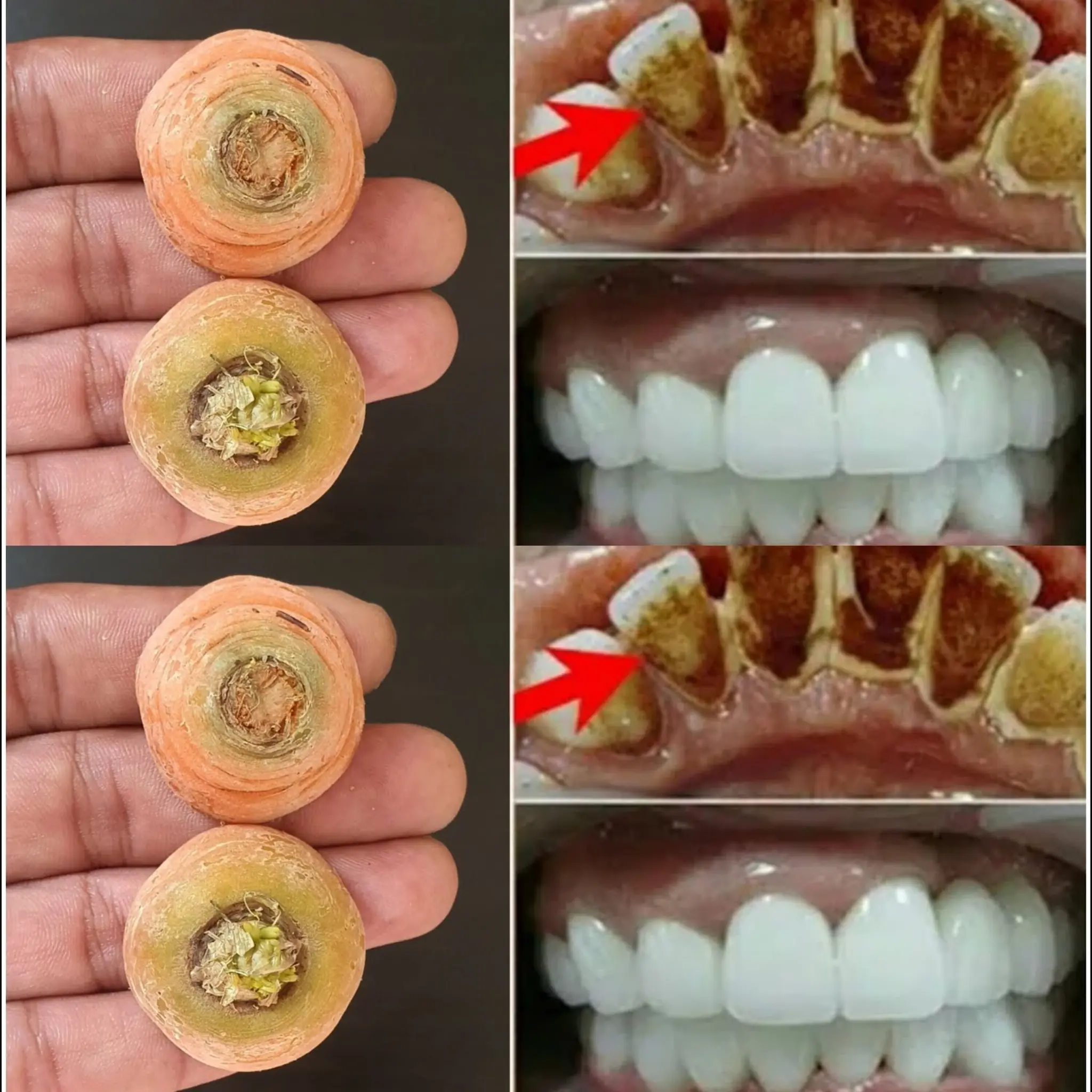 Whiten Your Teeth Naturally in 2 Minutes!Carrot Tops: A Surprising Home Remedy for a Bright Smile