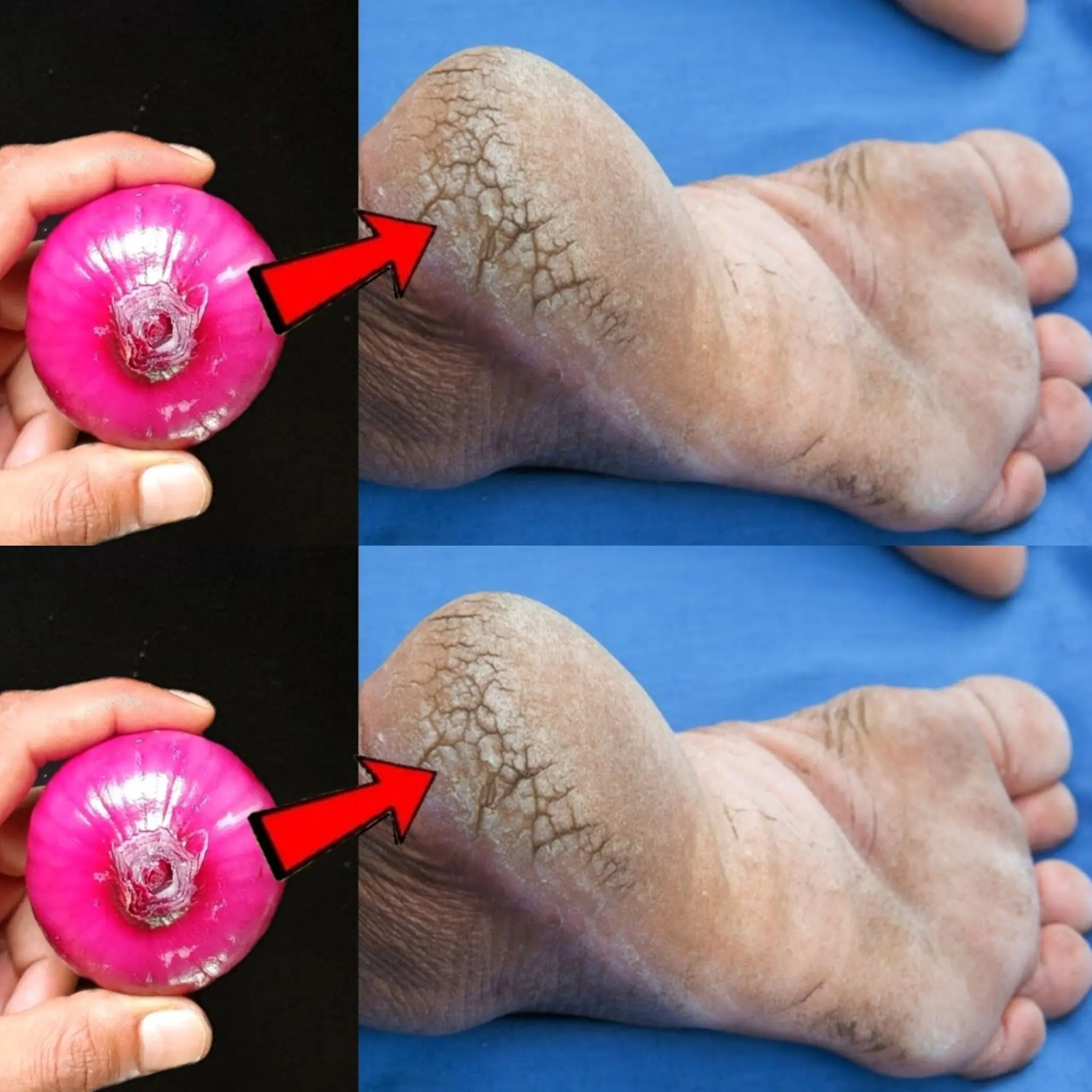 Remove Cracked Heels and Get Beautiful Feet Permanently! 👣✨