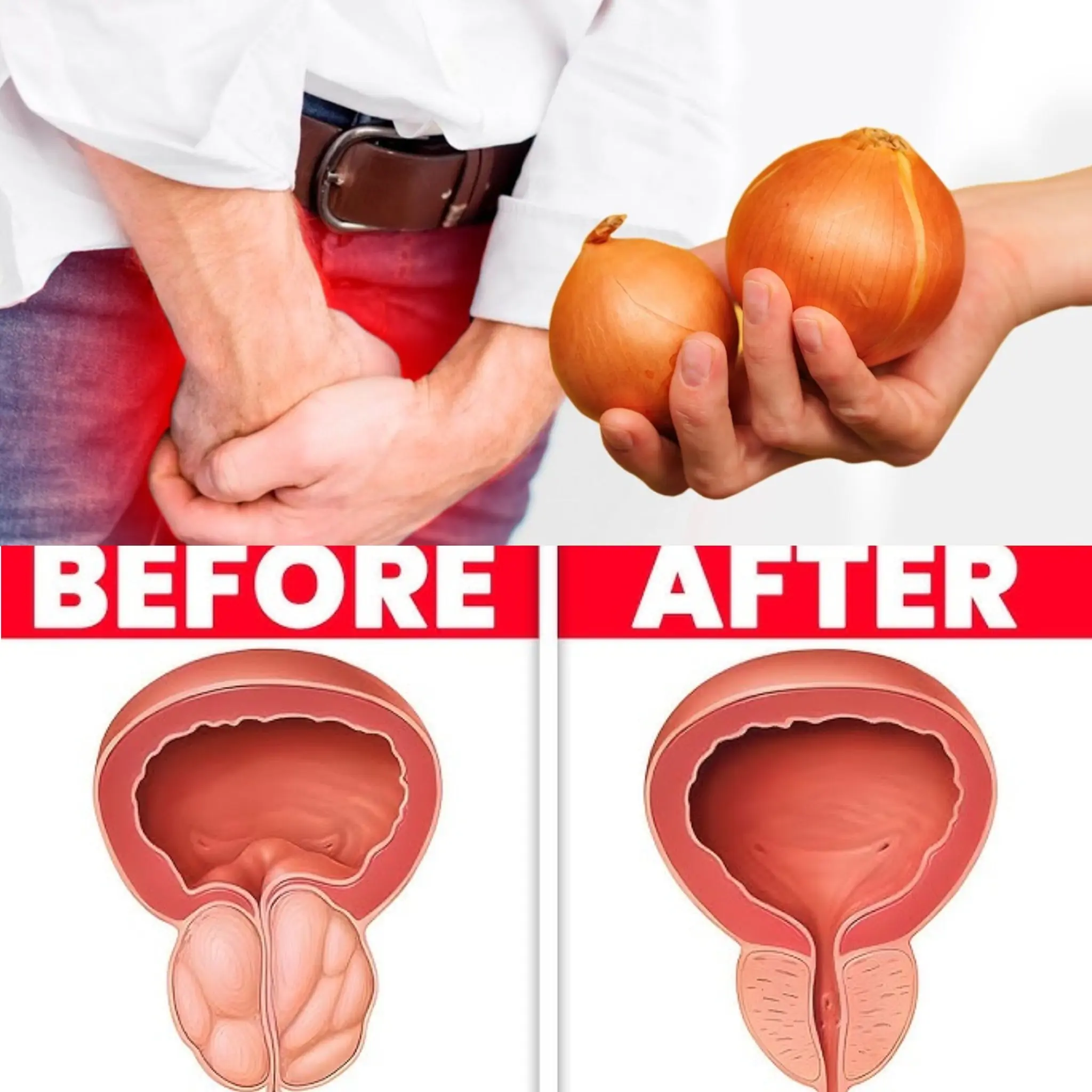 Revitalizing Onion Remedy for Bladder and Prostate Health