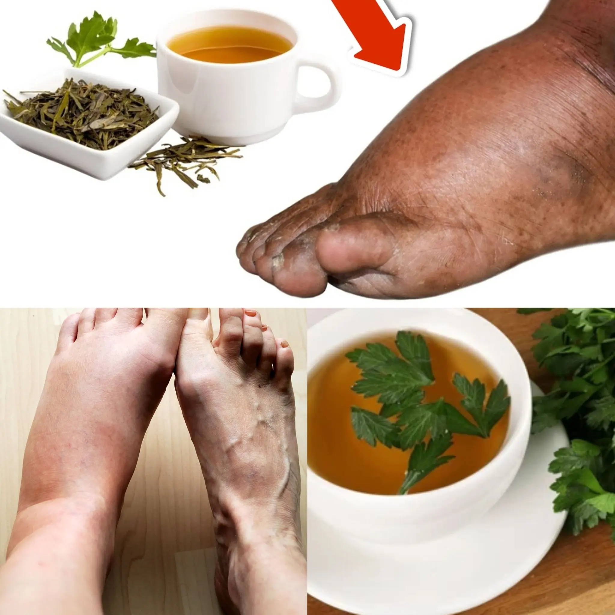 Drink Parsley Tea and Say Goodbye to Swollen Legs, Ankles, and Feet! ??