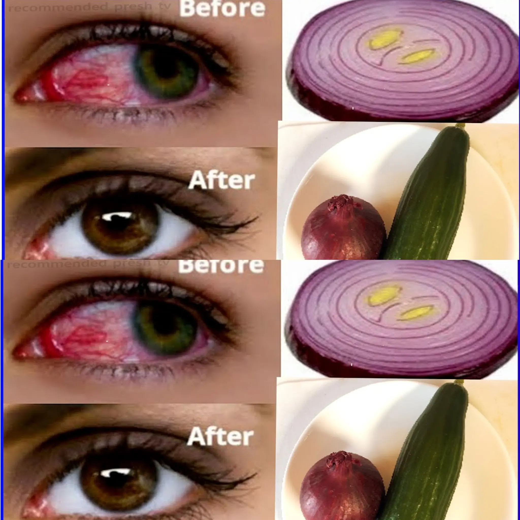 Improve Your Eyesight Naturally at Home in 5 Days – With Onion? Here’s the Truth!