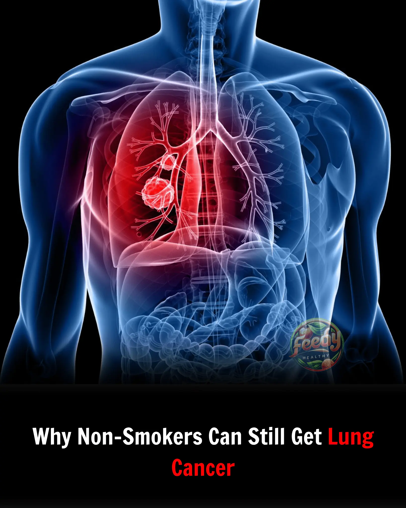 Why Non-Smokers Can Still Get Lung Cancer