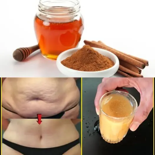 Eat Cinnamon & Honey in the Morning β Belly Fat Will Melt Away! No Exercise, No Diet!