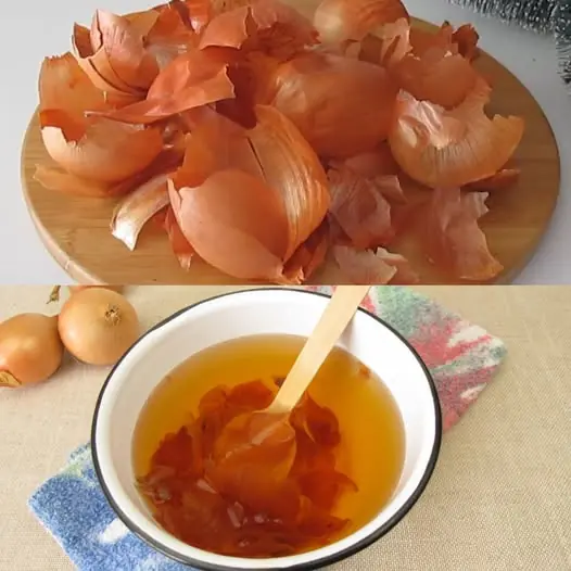 Bladder and Prostate Will Be Like New! Grandpaโs Old Recipe with Onion Peels โ Healthy, Natural, and Easy!