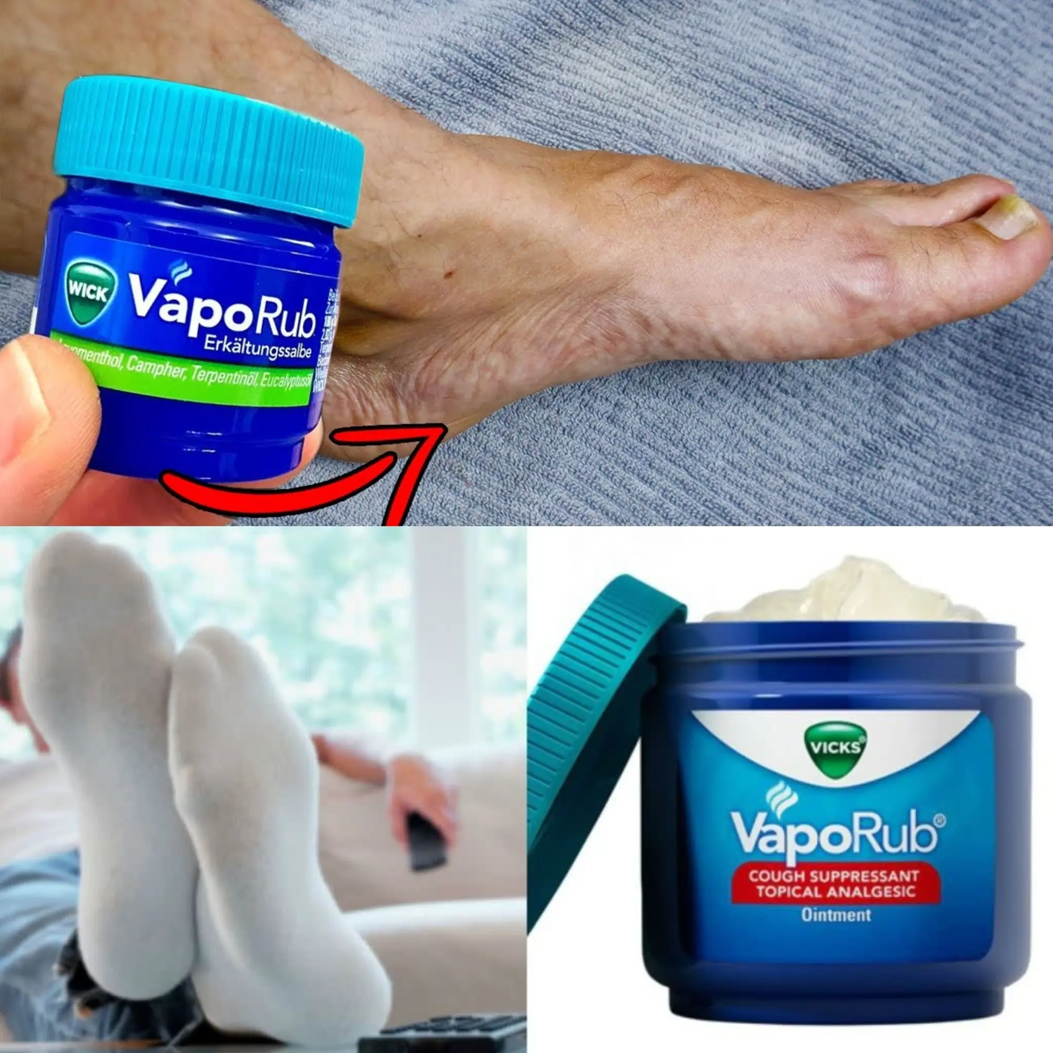 I Never Thought I Would Use It Like This! 💥 (UNBELIEVABLE Result) 🤯 – VapoRub on Feet!