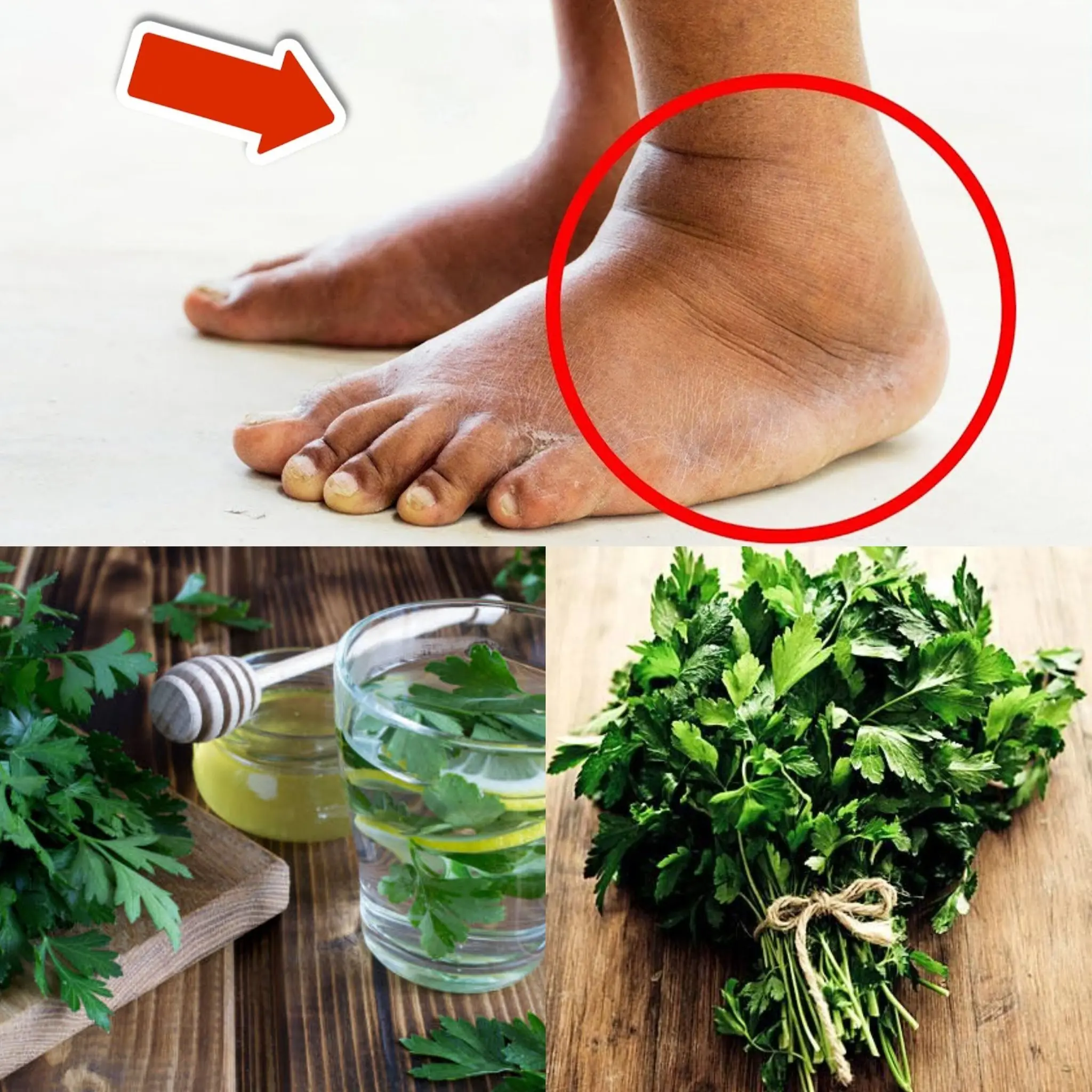 Eat THIS to Remove Swelling from Legs and Feet 💥 (Incredibly Fast!) 🤯 – The Power of Parsley