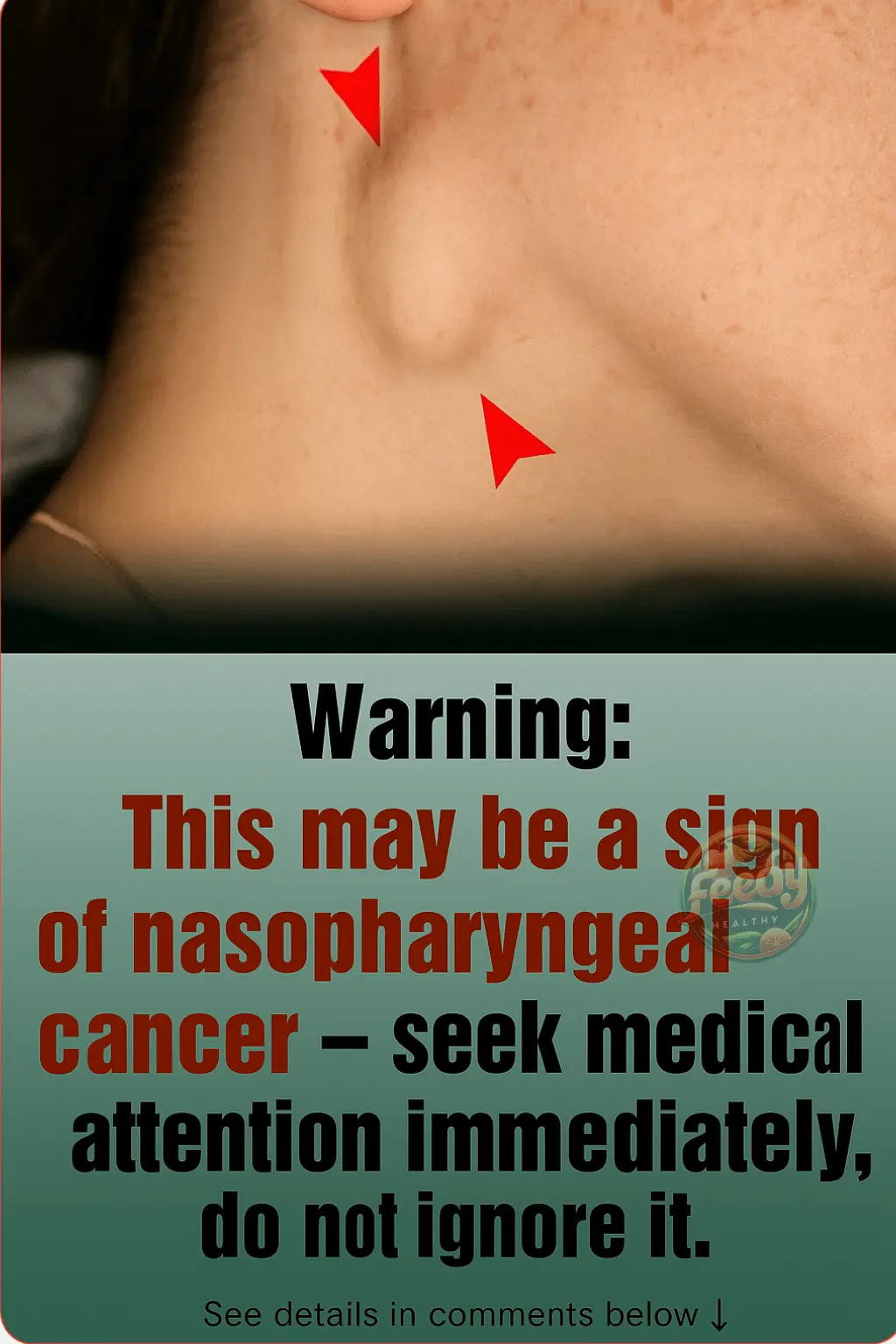 Early Warning Signs That May Indicate Advanced Nasopharyngeal Cancer